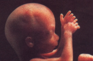 19 week old Baby in Mother's Womb
